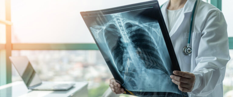 Doctor examining a chest X-ray image near a bright hospital window.